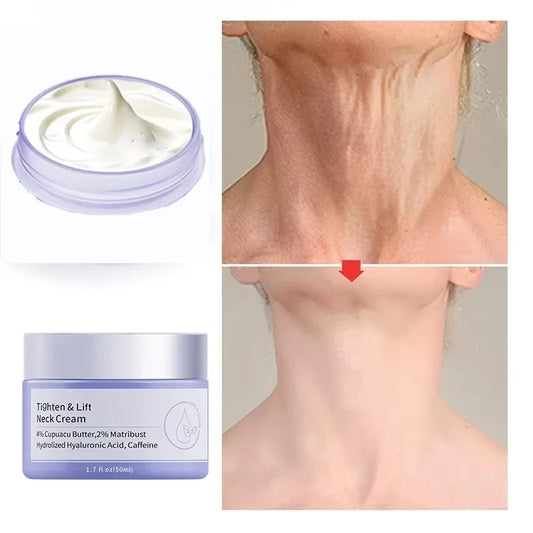 Radiant Neck Rejuvenation Cream™