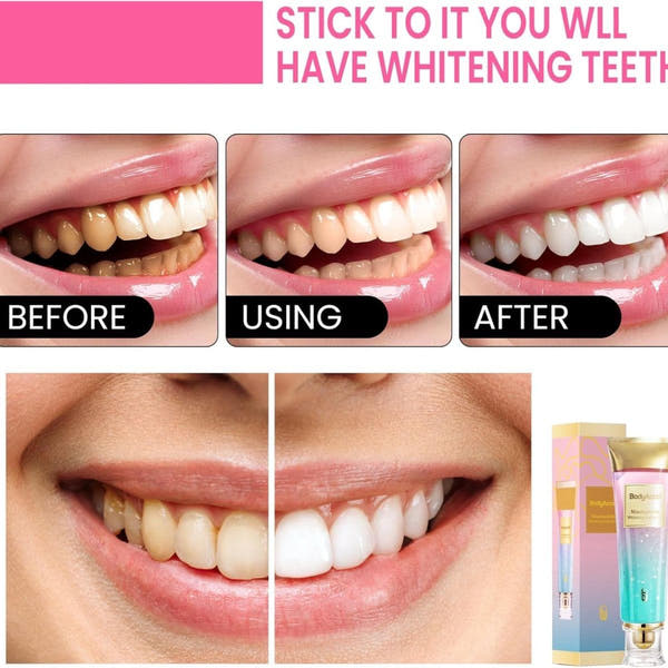 bodyaccel Whitening Toothpaste™ in 1 week
