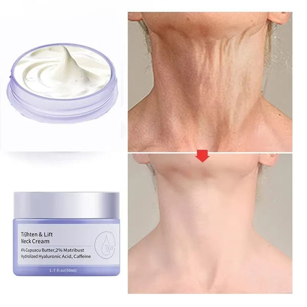 Radiant Neck Rejuvenation Cream™
