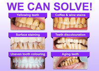 bodyaccel Whitening Toothpaste™ in 1 week